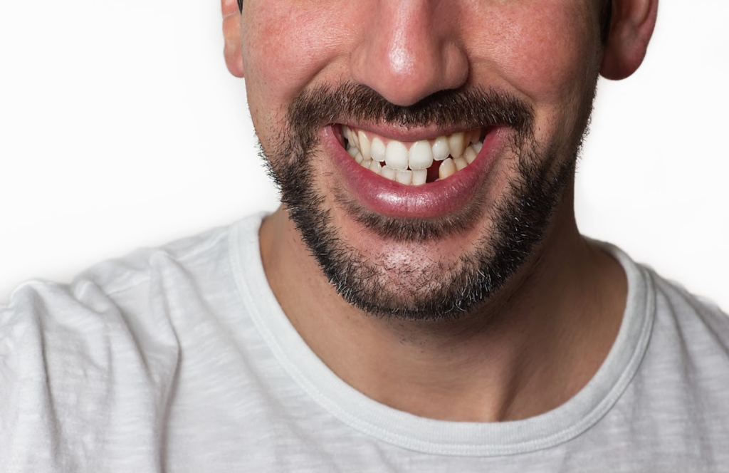 A man smiles, showing his missing front lower tooth.